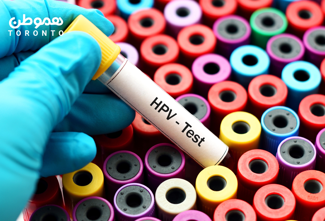 درخواست انجمن سرطان کانادا  از وزارت بهداشت برای تایید تست خانگی HPV